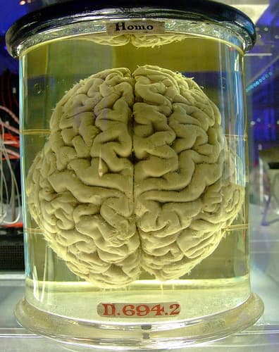 Heavy and Long-Term Marijuana Use Causes Brain Shrinkage