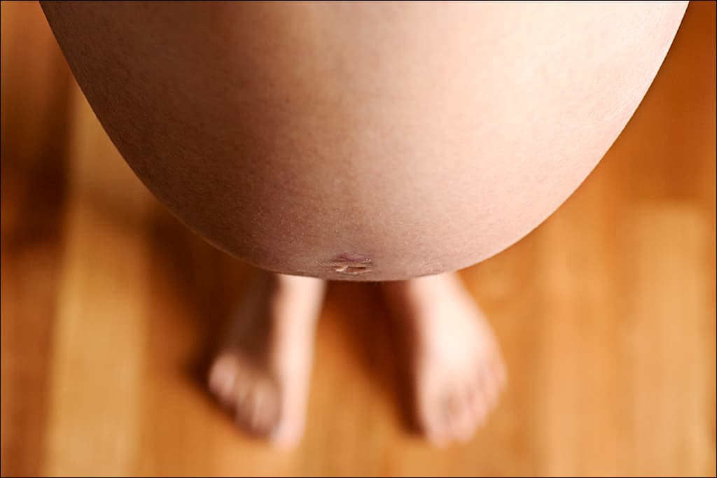 Methadone or Suboxone during Pregnancy?