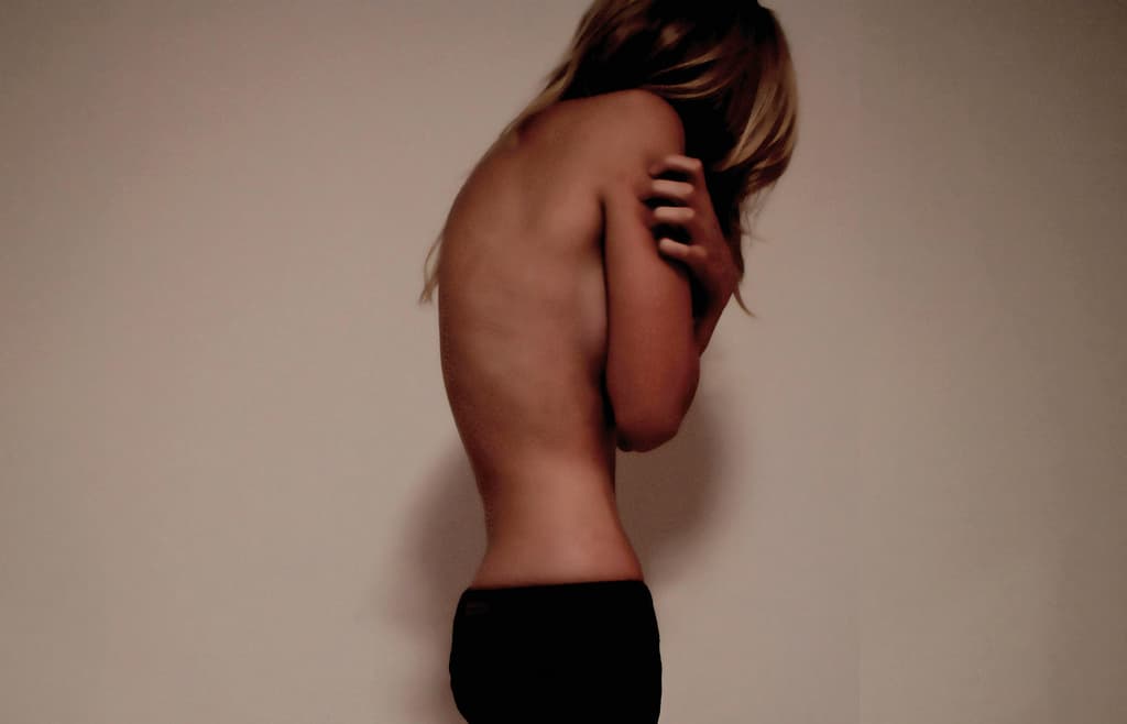 Anorexia Is the Most Dangerous Mental Illness – Anorexics Almost 6 Times More Likely to Die
