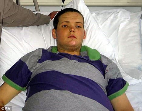 19 Year Old Briton with Alcohol Destroyed Liver Doesn’t Meet Transplant Guidelines