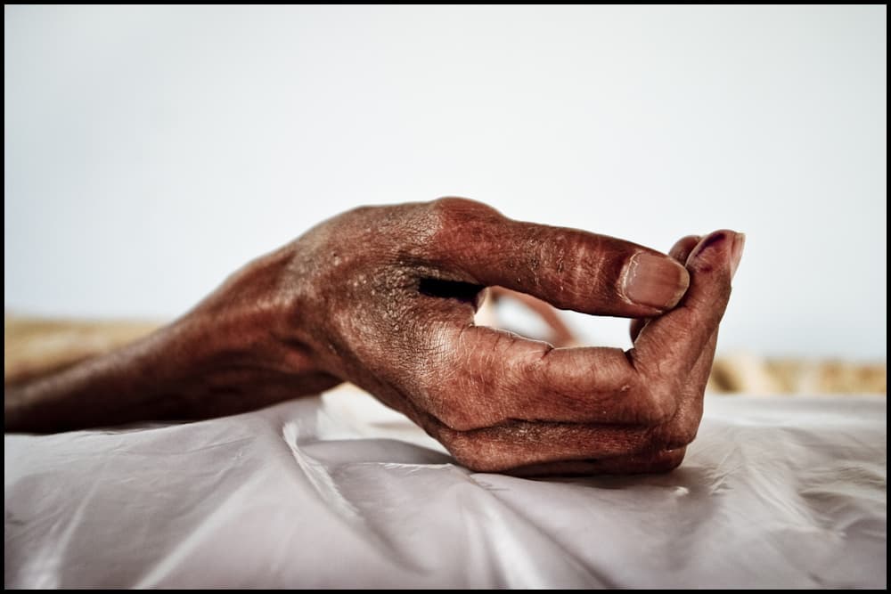 East African Heroin Addicts Are Injecting the Blood of Other Heroin Addicts to Share a High