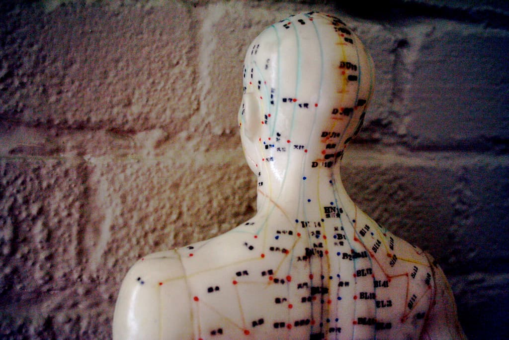 Acupuncture Works as Well as CBT for PTSD